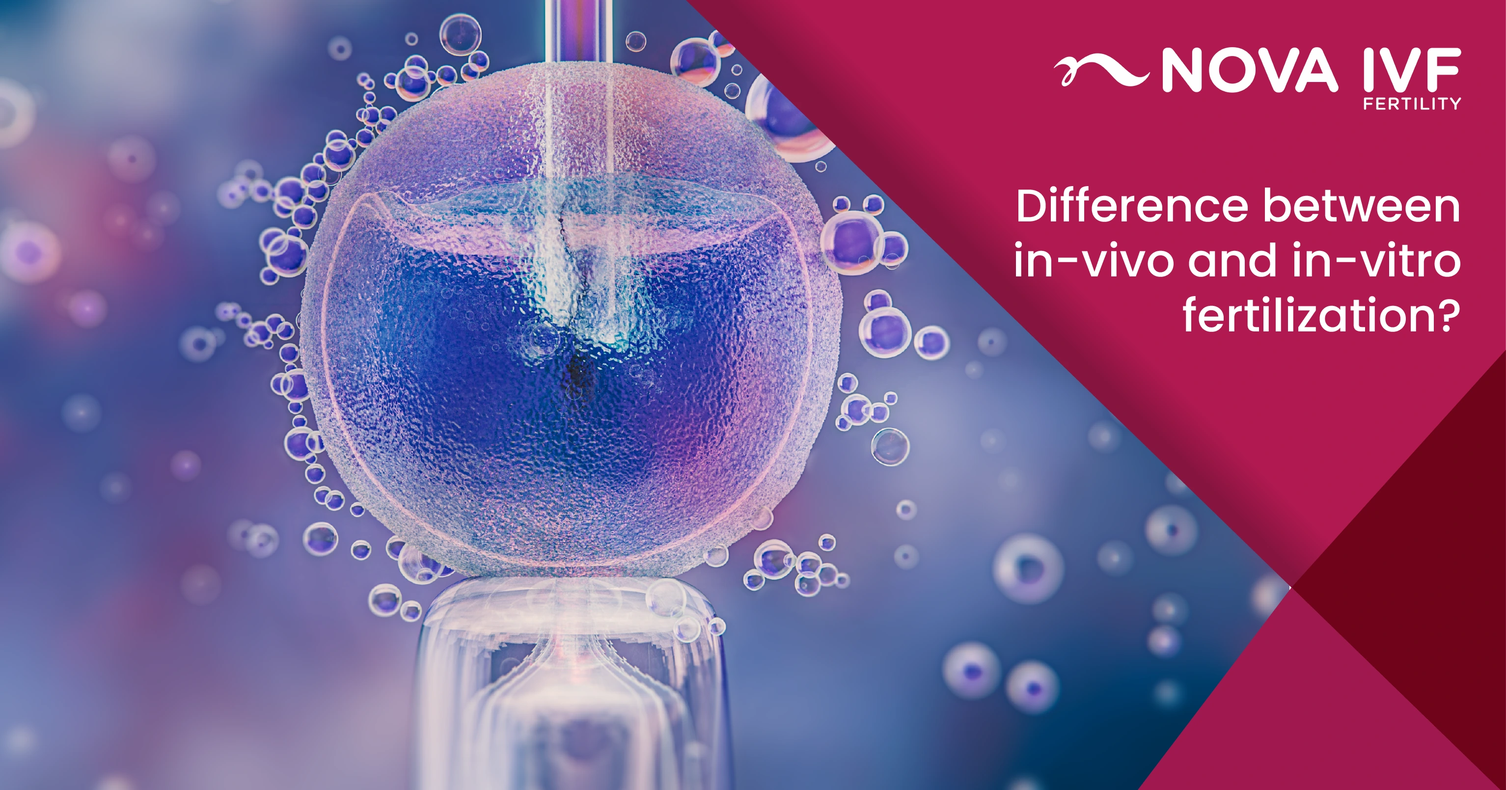 Understanding In Vivo vs In Vitro Fertilization: Differences, Benefits, and Challenges