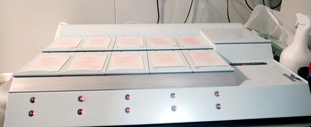 Advanced Fertility Technology at Nova IVF Fertility Centre in Kolhapur