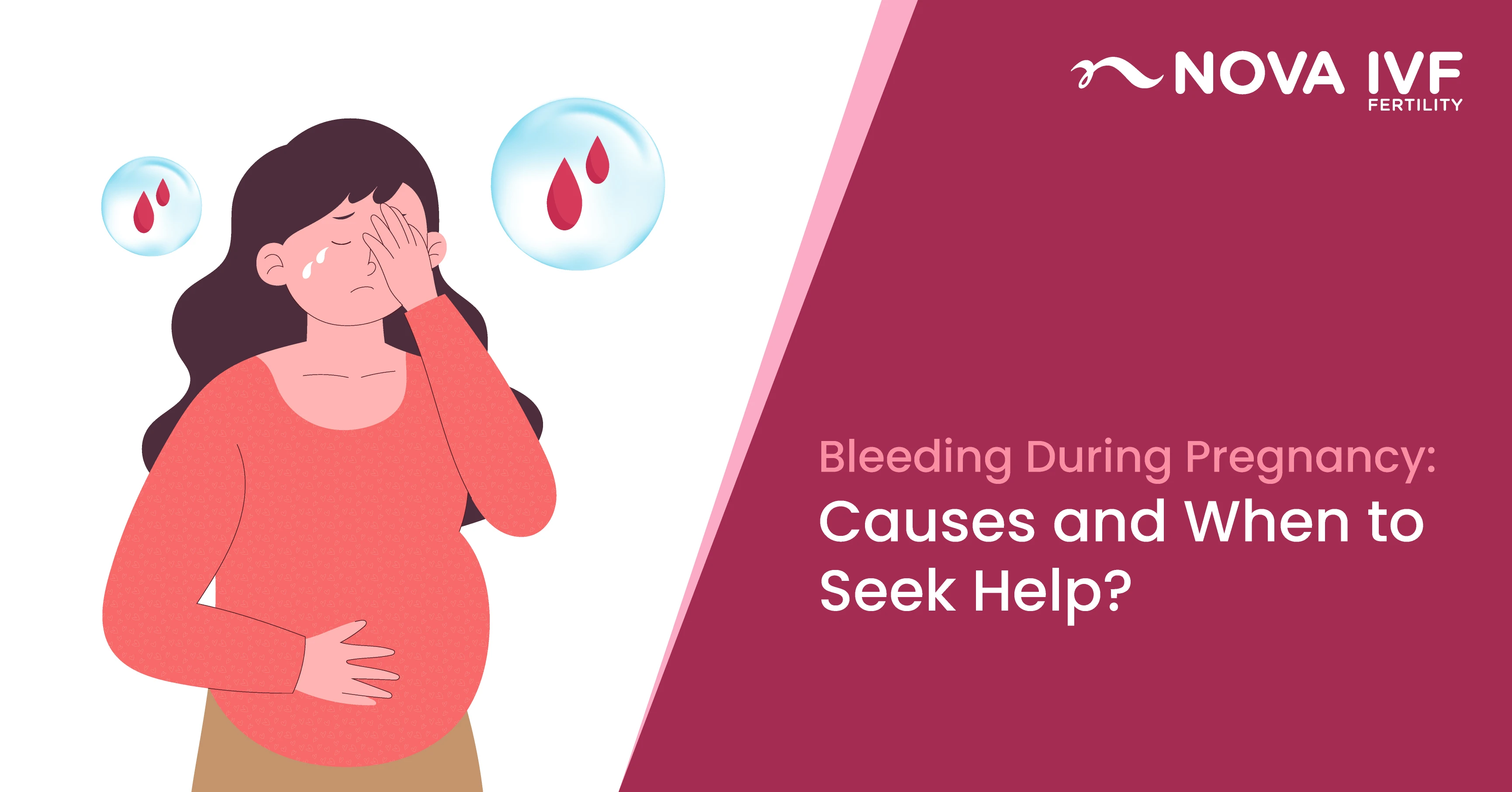 Bleeding During Pregnancy: Causes and When to Seek Help 