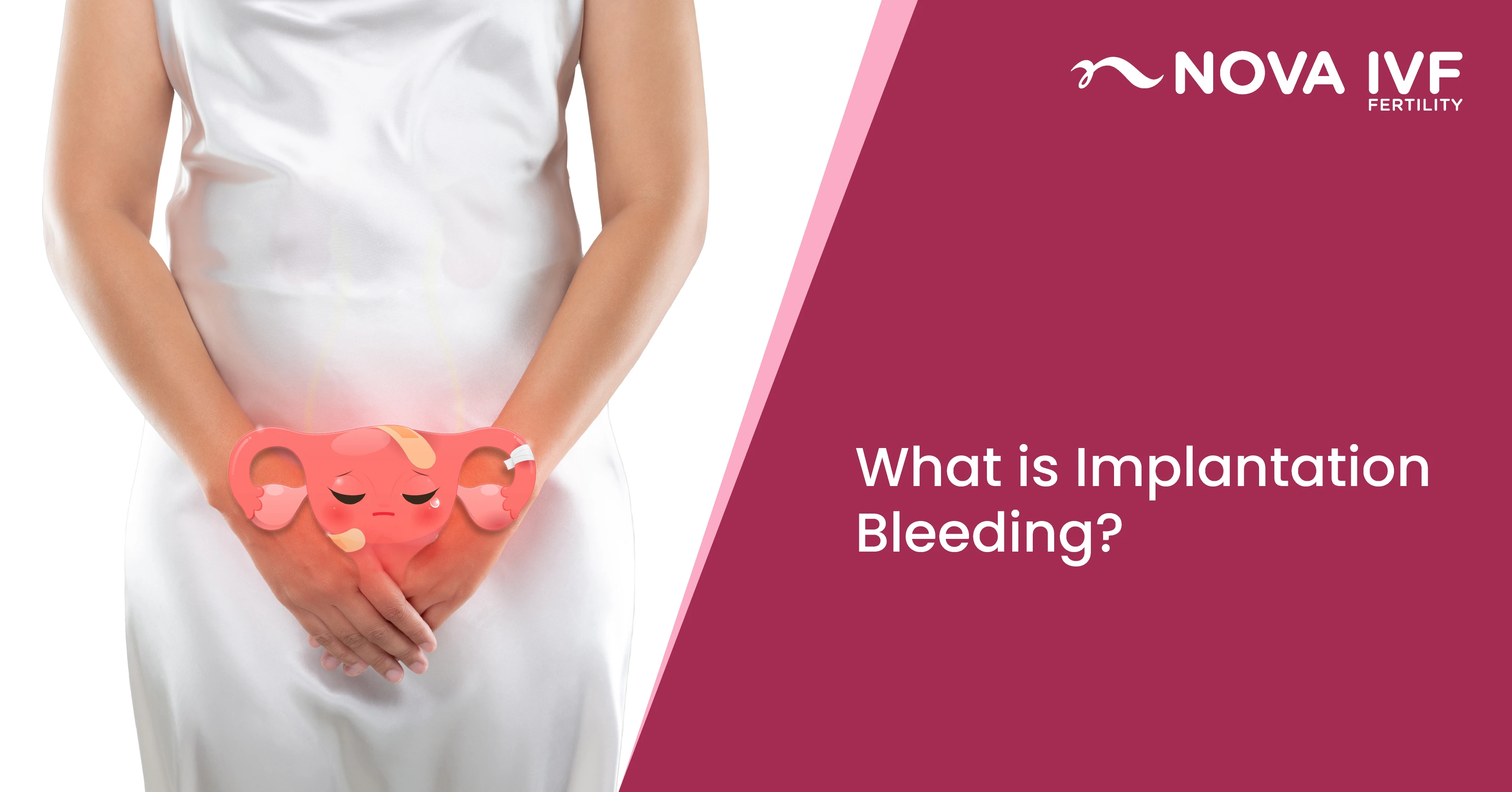 What is Implantation Bleeding? 