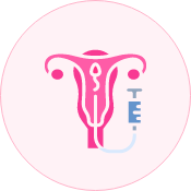 Intrauterine Insemination (IUI)