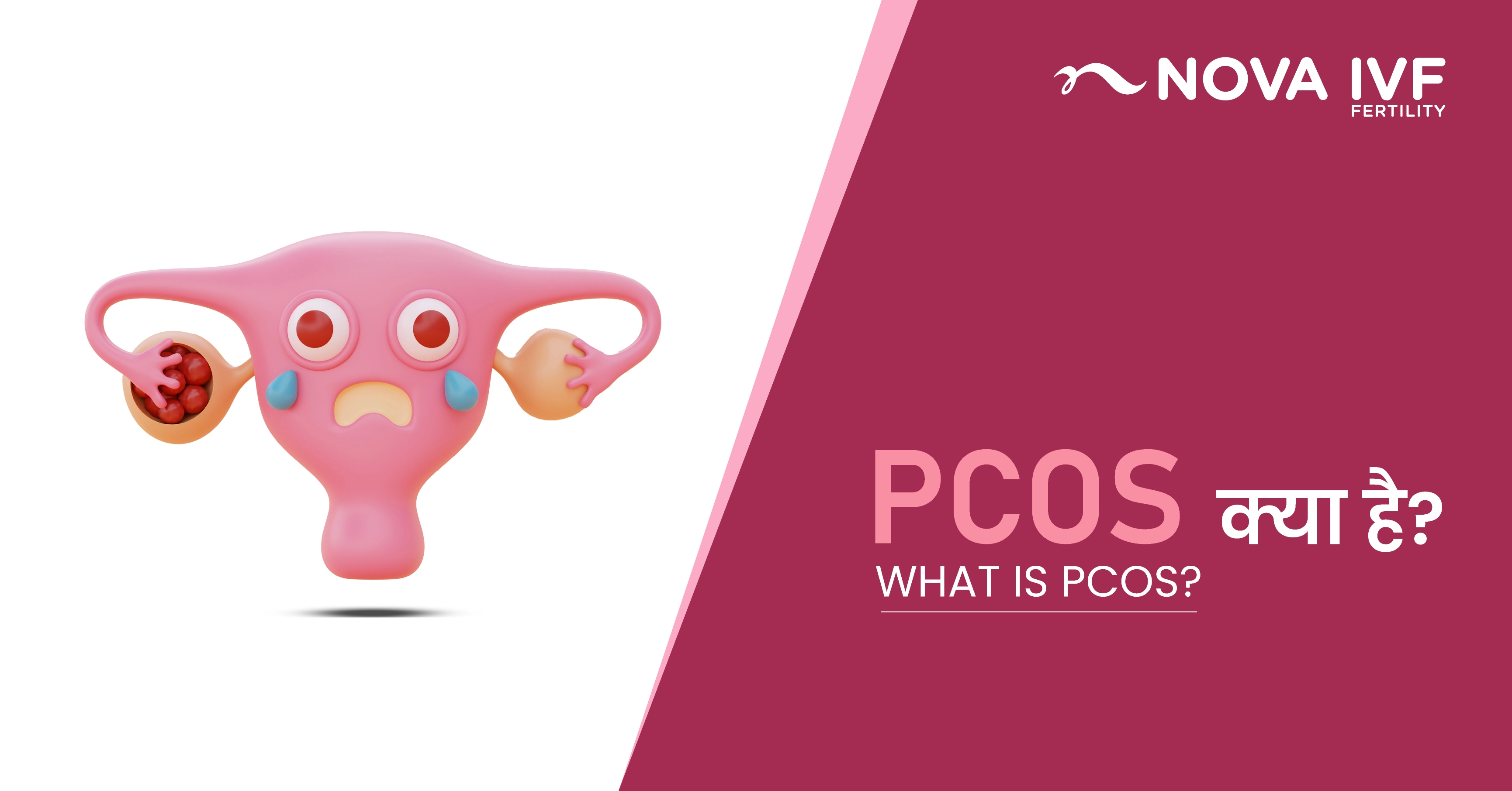PCOS क्या है? 