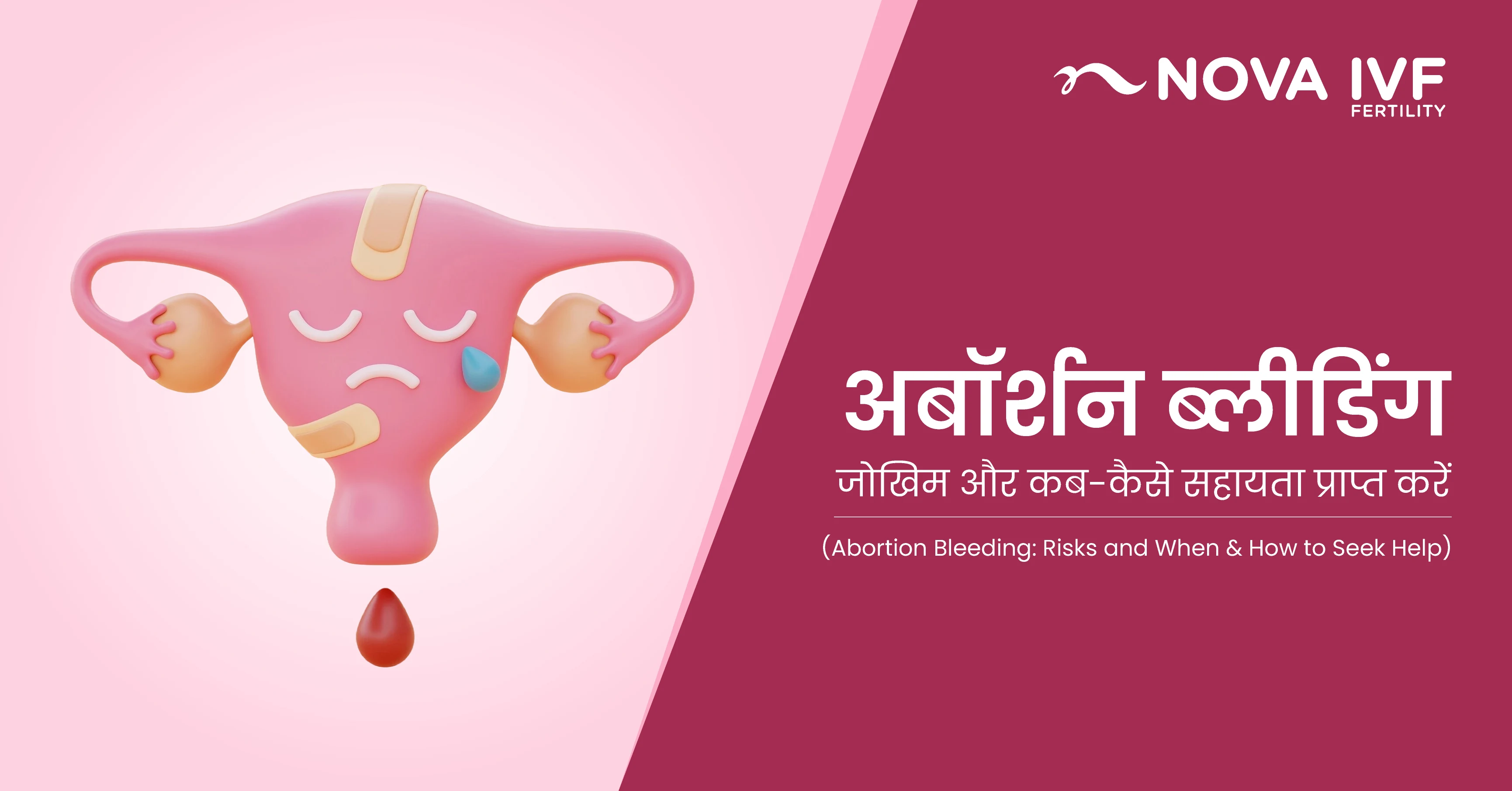 एबॉर्शन ब्लीडिंग : जोखिम और कब-कैसे सहायता प्राप्त करें (Abortion Bleeding: Risks and When & How to Seek Help) 