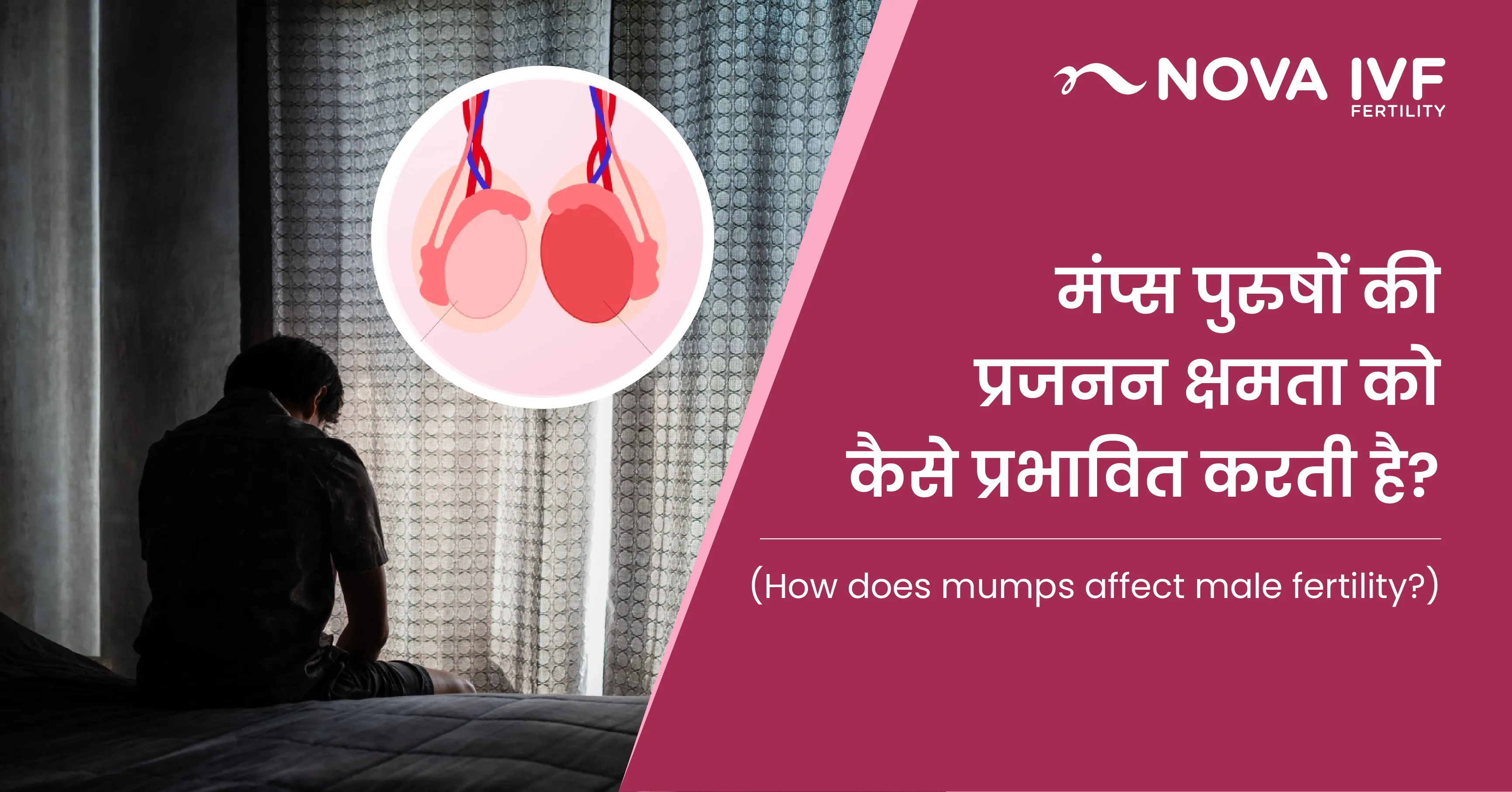 मंप्स पुरुषों की प्रजनन क्षमता को कैसे प्रभावित करती है? (How Does Mumps Affect Male Fertility in Hindi)