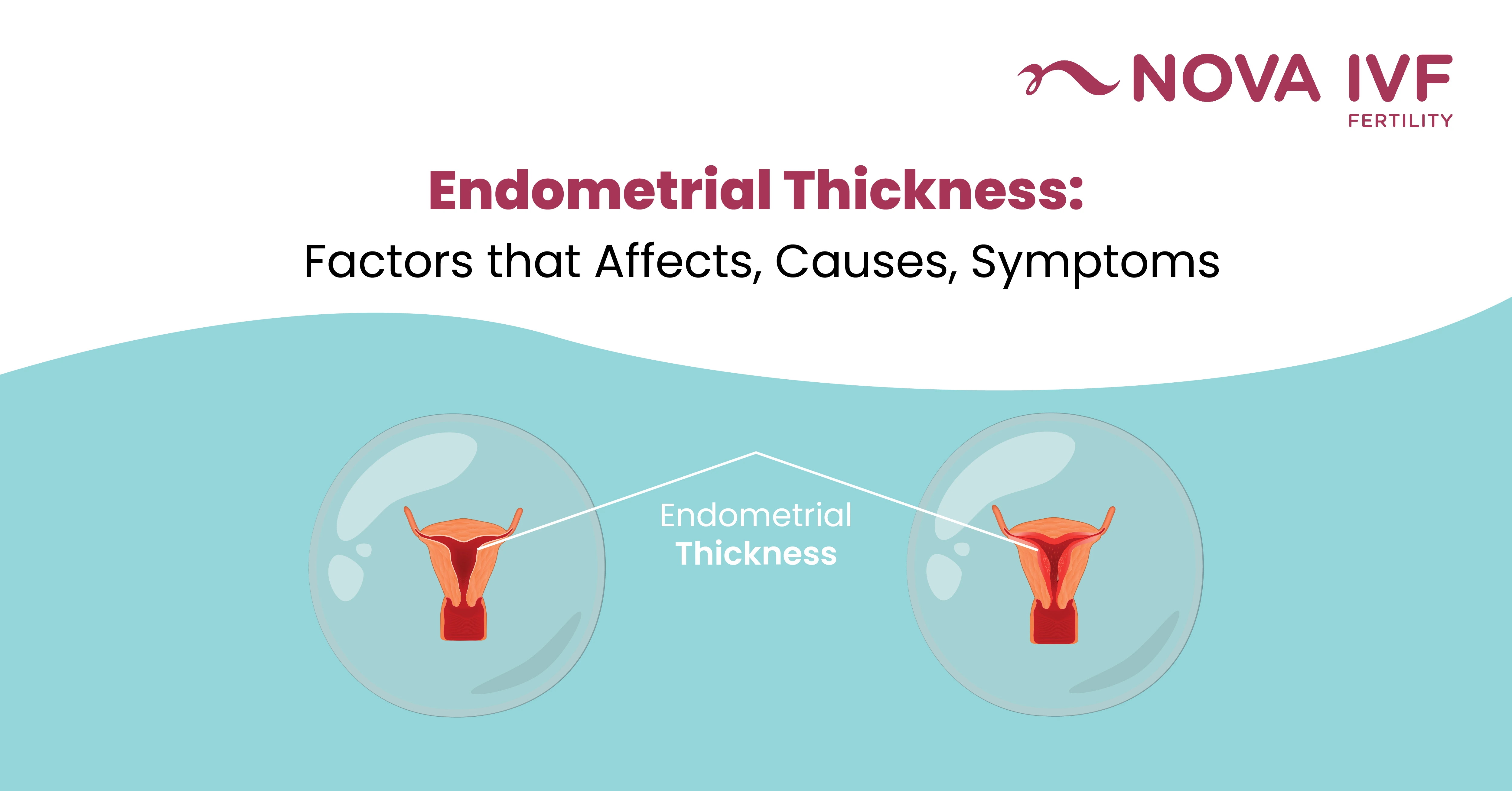 Endometrial Thickness for IVF: Key Factors & How to Improve It